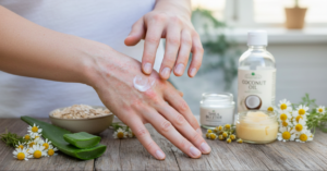 Navigating Seasonal Allergies and Eczema