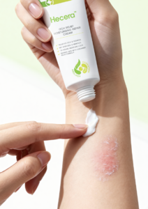 Consulting a Dermatologist: When and Why